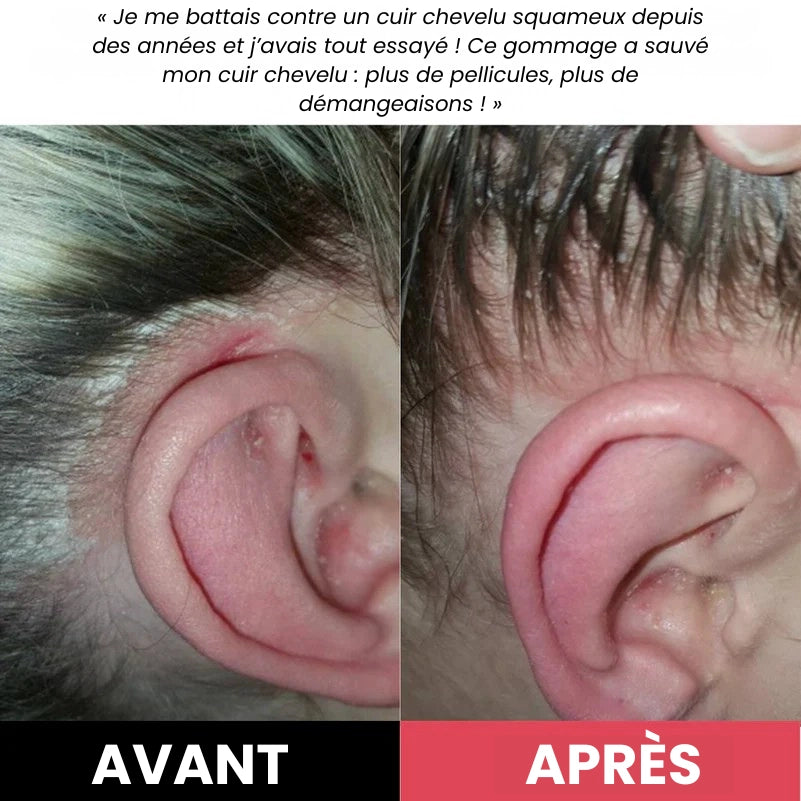 Revitalise + Répare — Gommage Cuir Chevelu | 200 ml