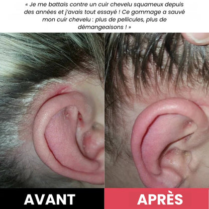 Revitalise + Répare — Gommage Cuir Chevelu | 200 ml